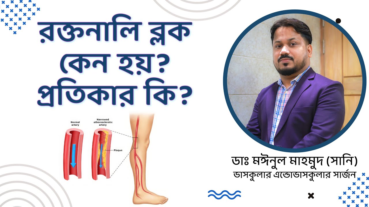 রক্তনালির ব্লকের লক্ষণ, প্রতিরোধে করণীয়। পায়ের রক্তনালী ব্লক হলে করনীয় কি?রক্তনালি ব্লক কেন হয়?