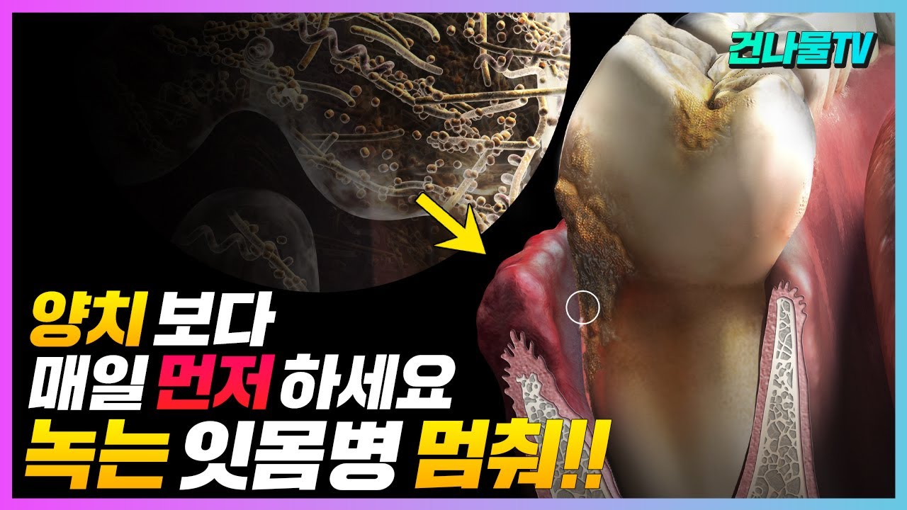양치보다 매일 먼저하면 잇몸병 사라지고 잇몸이 튼튼해져요!