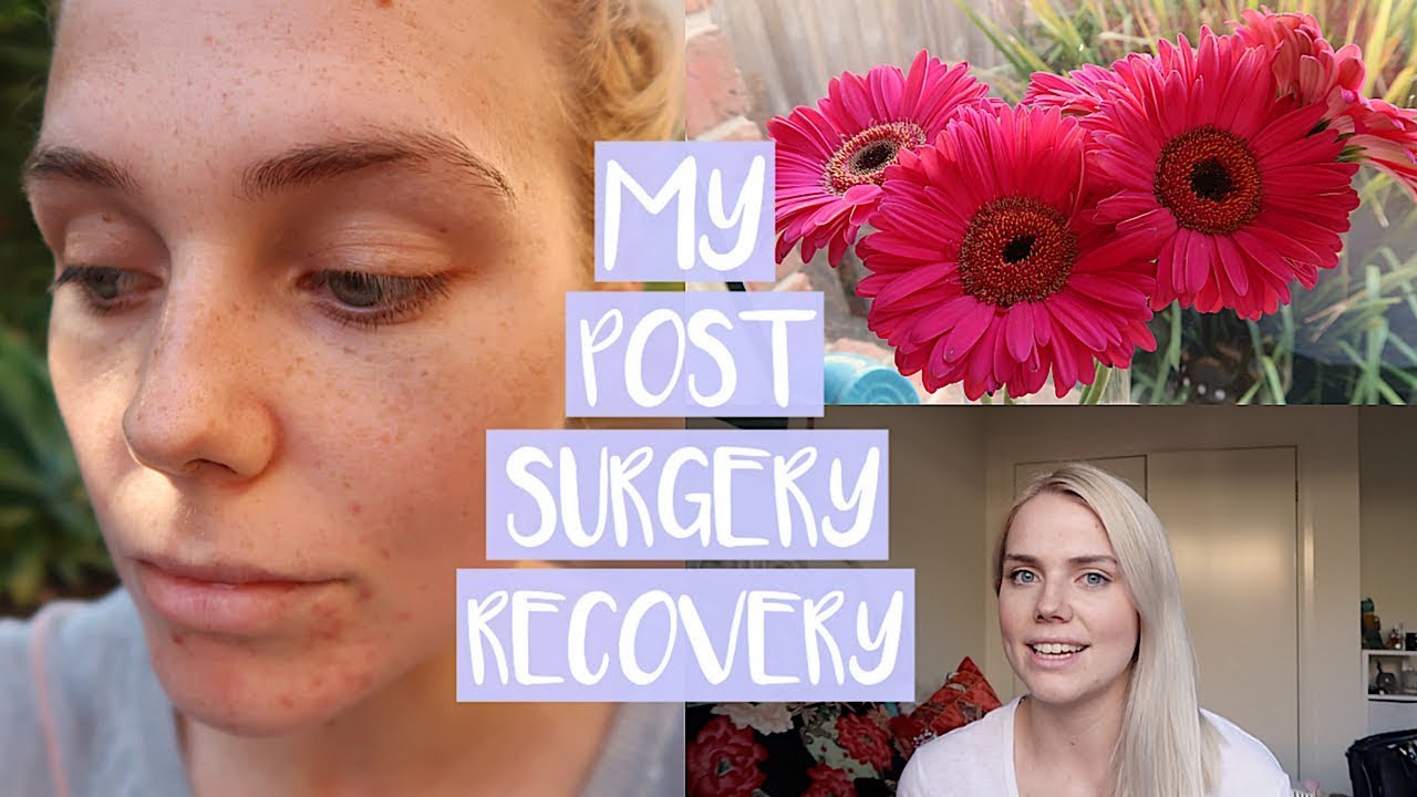 WHAT TO EXPECT AFTER NASAL SURGERY | Second Week of Post-Sinus Operation Recovery!