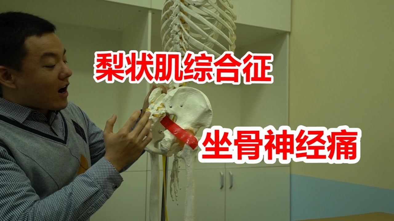 坐骨神经痛？屁股疼、腿疼、脚疼，腰不疼？怀疑梨状肌综合征