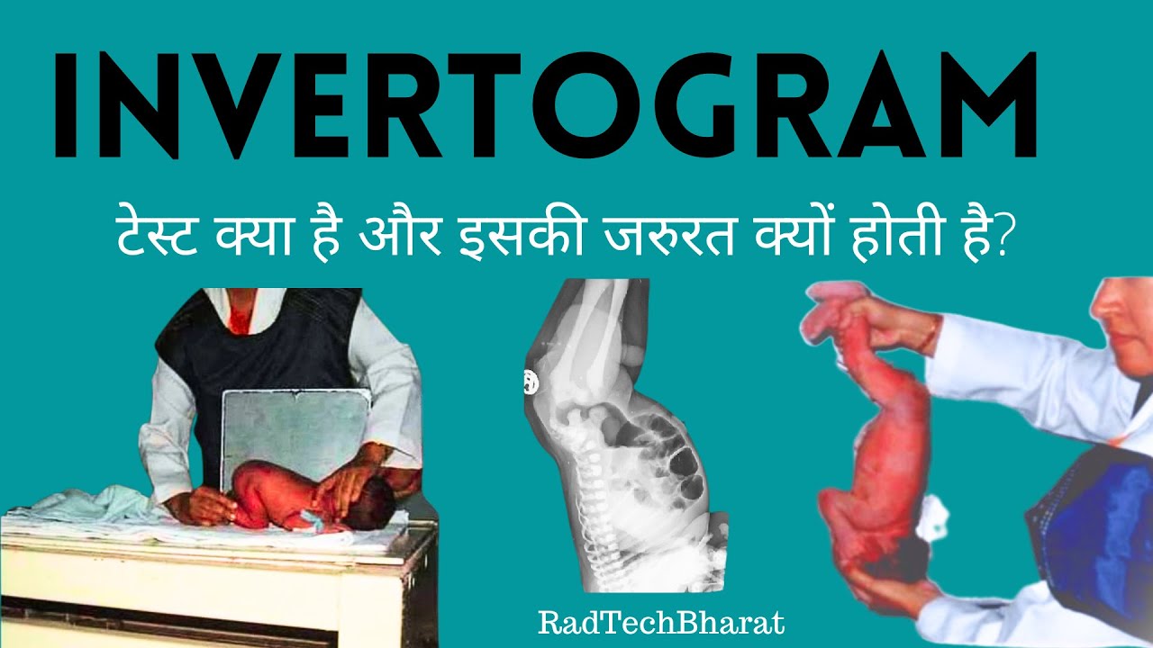 INVERTOGRAM PROCEDURE | INVERTOGRAM XRAY POSITION | INVERTOGRAM TEST | RAD TECH BHARAT #radiology