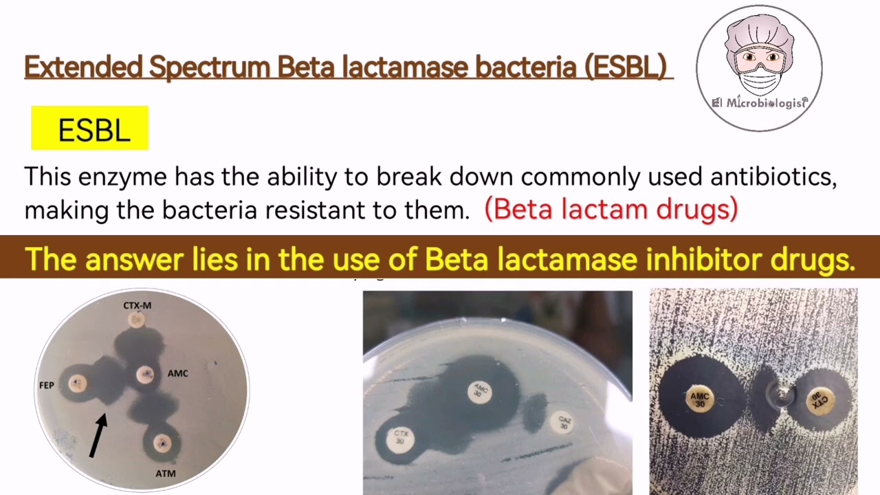 ESBL bacteria (Extended Spectrum Beta-lactamase Bacteria) - Antibiotic Resistance (English)