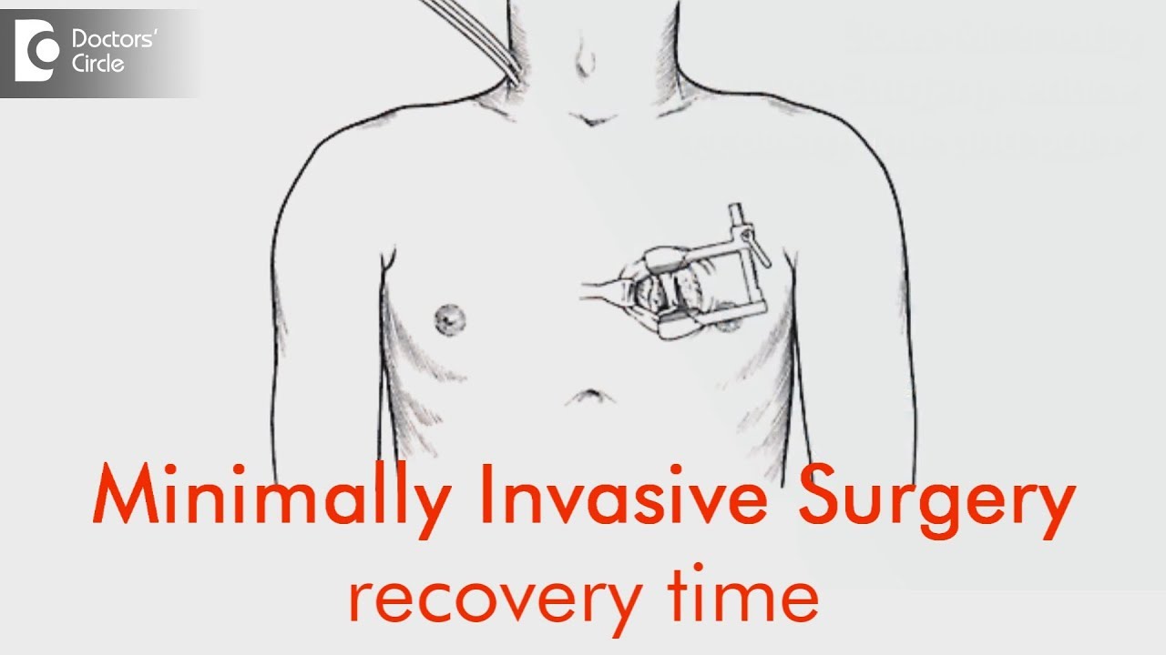 Minimally Invasive Surgery recovery time -  Dr. Raghavendra Chikkatur