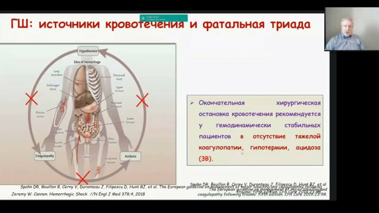 Геморрагический шок  проект кл рекм ФАР  Заболотских И.Б. 2021