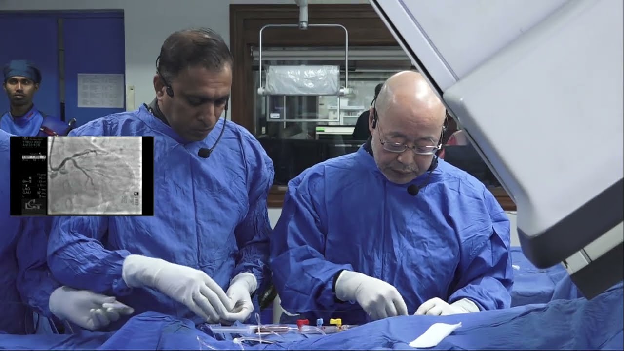 LMCA bifurcation with mid LAD, OM1 and OM2 stenoses by Dr. Saito with Rajni