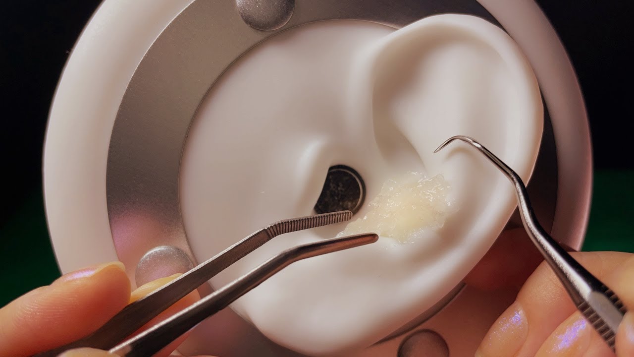 속도감 있게 긁어내는 쇠갈고리 수술 롤플🧪 굳고 꾸덕한 염증 긁어내기ㅣRPㅣASMRㅣ핀셋&갈고리&실리콘
