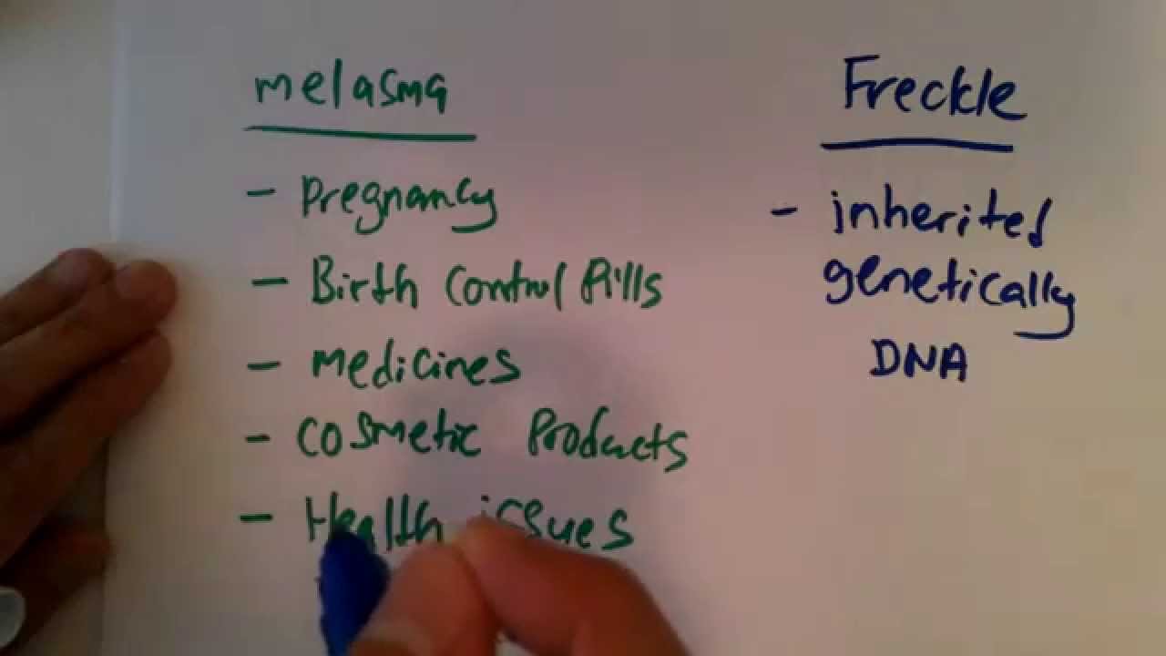 Lesson 2 : Differences between Melasma & Freckle
