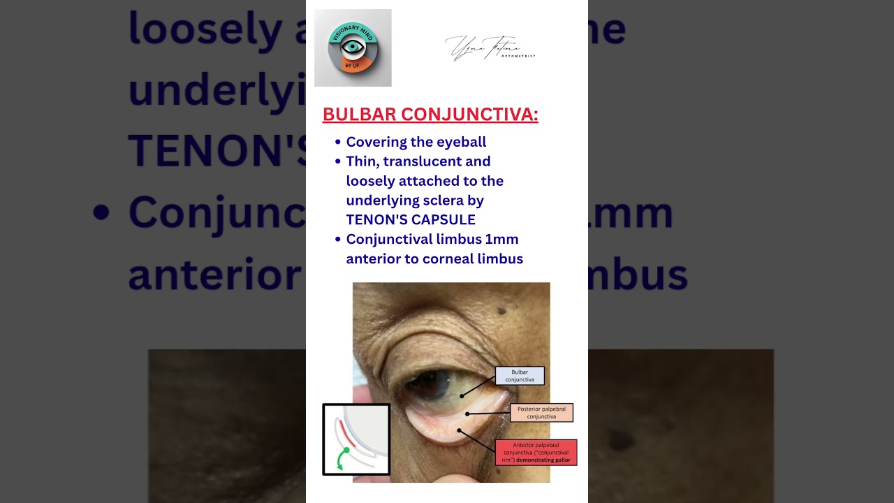 ANATOMY & PHYSIOLOGY OF CONJUNCTIVA #anatomy #physiology #eyecare #eyecareprofessionals #optometry
