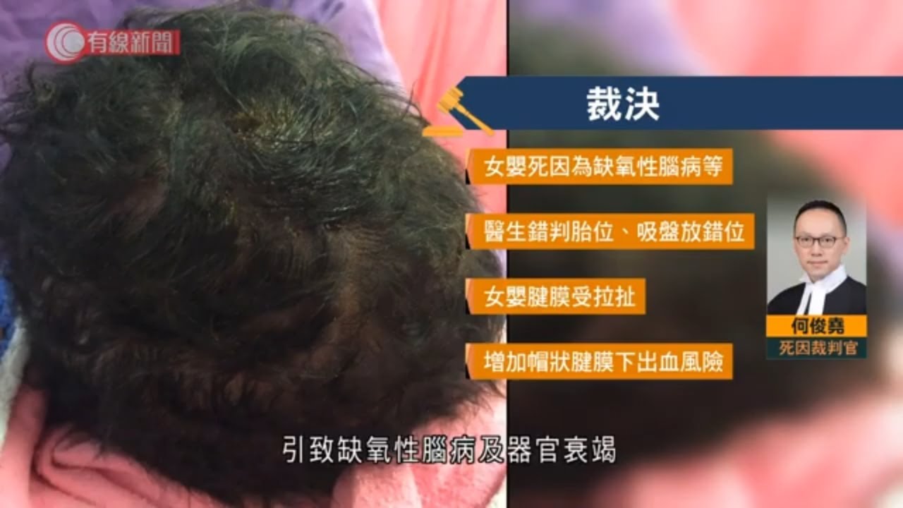 女嬰真空吸引術出生八日後夭折　官料醫生用吸盤時錯判胎位　裁死於不幸 - 20211123 - 港聞 - 有線新聞 CABLE News