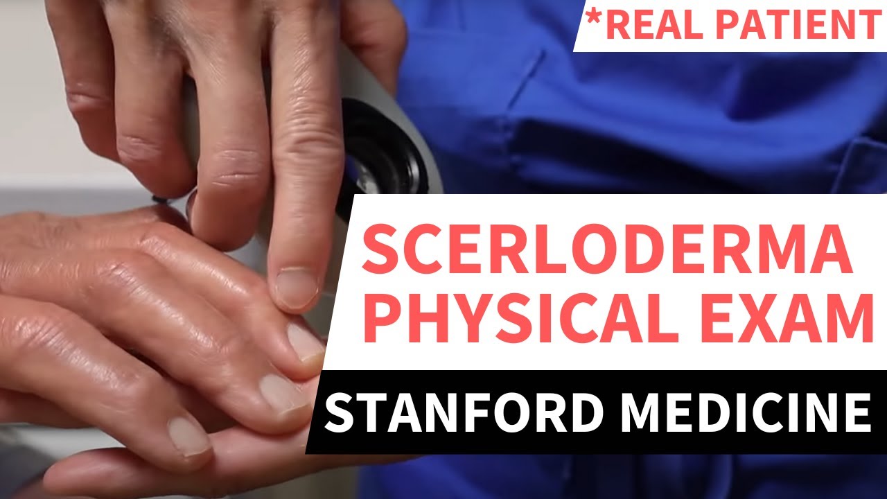 Scleroderma Physical Exam — Stanford Rheumatologist Step-by-Step