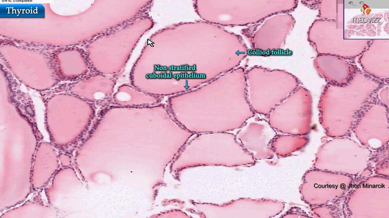 Histology of thyroid gland - Shotgun Histology