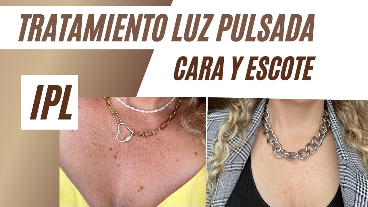 TRATAMIENTO DE LUZ PULSADA, IPL. En cara y escote!!!