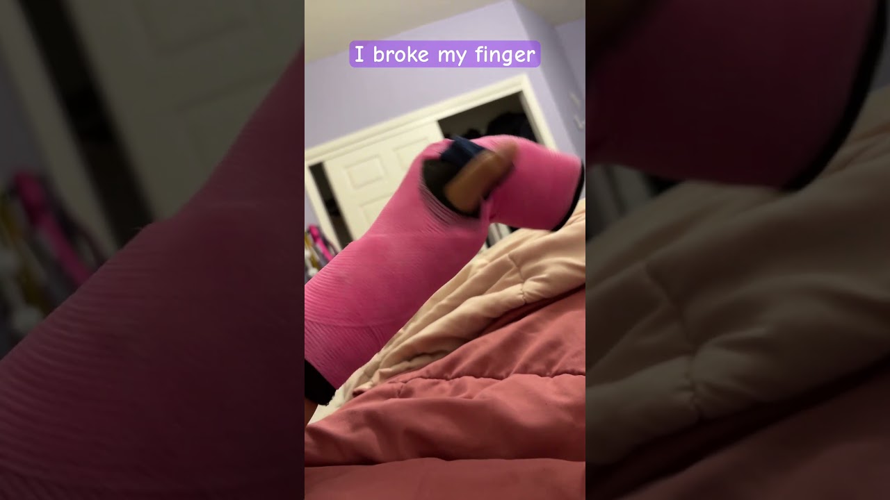 I broke my finger #brokenfinger #finger #cast #pinkcast