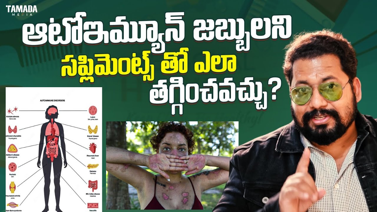 ఆటోఇమ్యూన్ జబ్బులని సప్లిమెంట్స్ తో ఎలా తగ్గించవచ్చు? Best Supplements To Cure AutoImmune Diseases