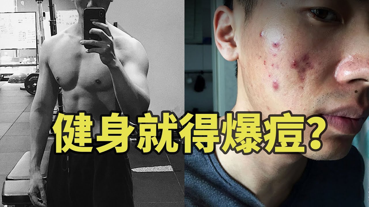 只需四点，拯救烂脸！解决你健身后爆痘的问题！【卓叔增重】