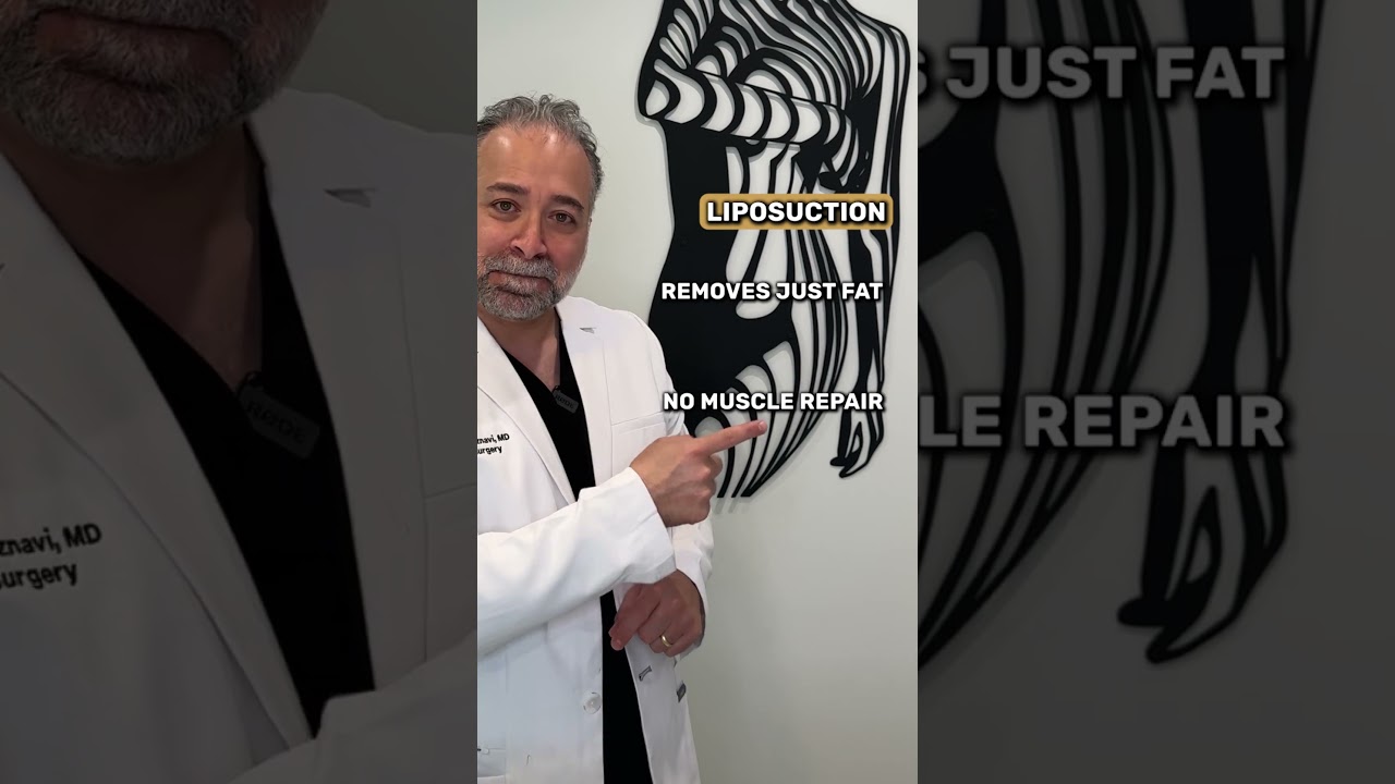 Liposuction Vs. Tummy Tuck #liposuction #tummytuck #plasticsurgery