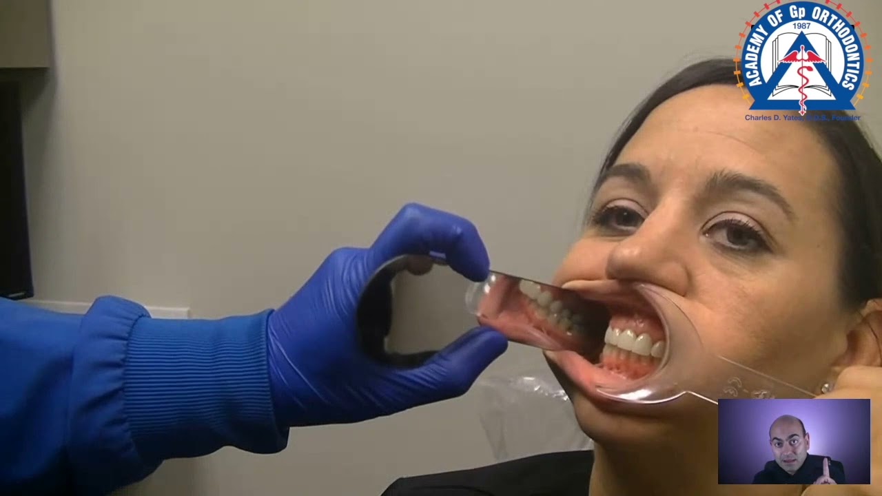 Monday Tip: Dental Photography with Buccal Mirrors