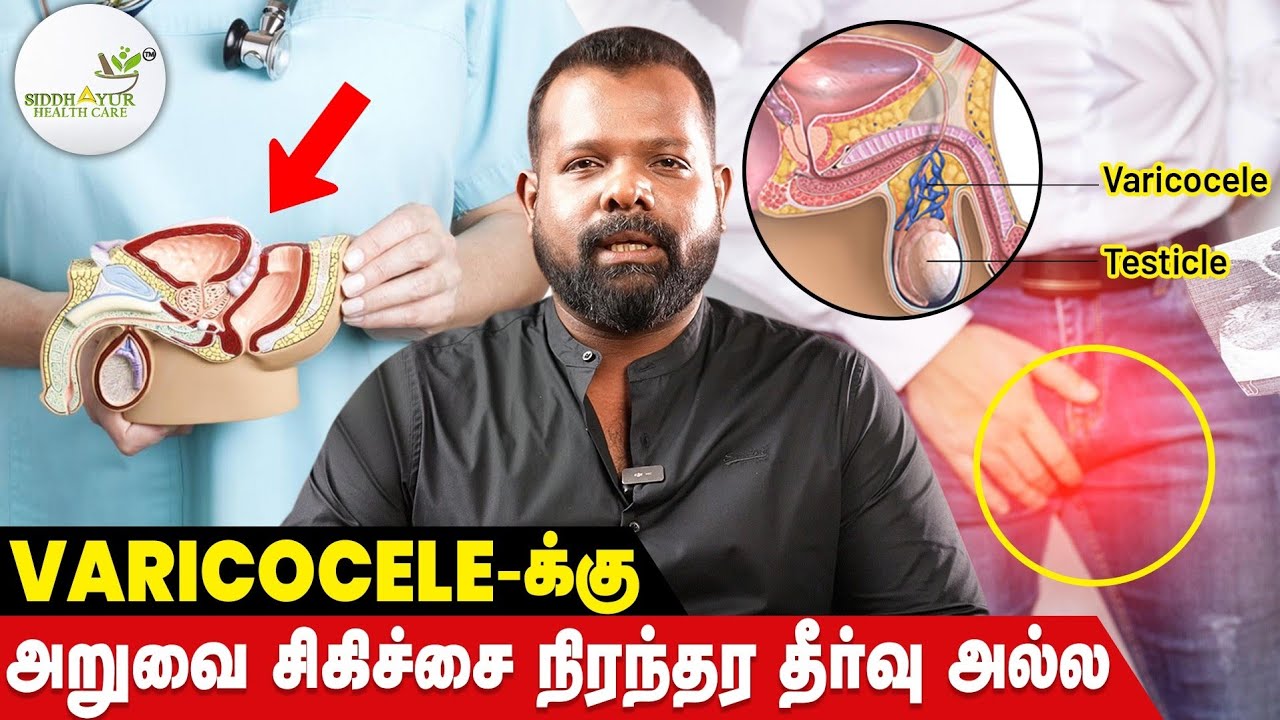 The Truth About Varicocele| varicocele Treatment in tamil | Siddhayur Healthcare | Dr.Gurugokul