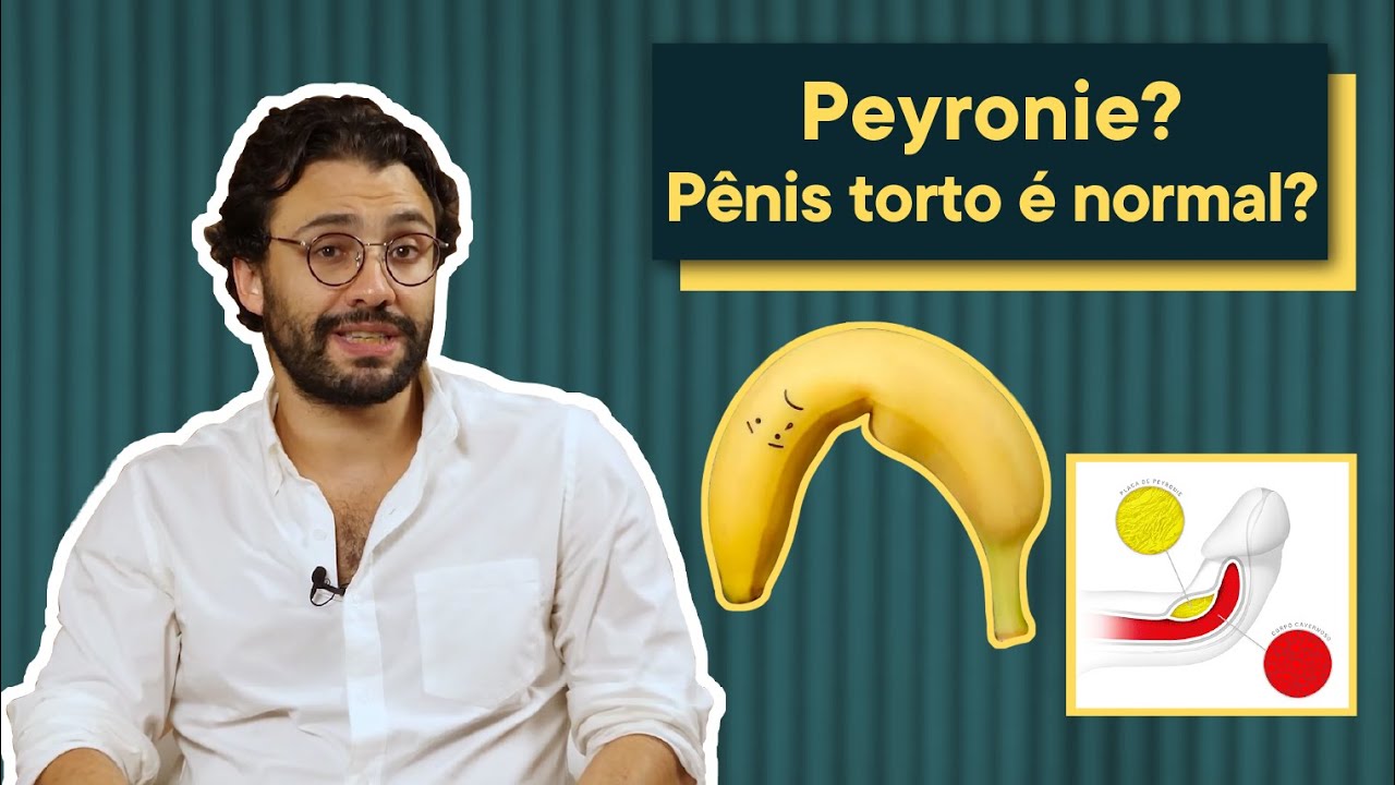 DOEN&Ccedil;A DE PEYRONIE: Penis torto &eacute; normal? Tem cura? Urologista explica!