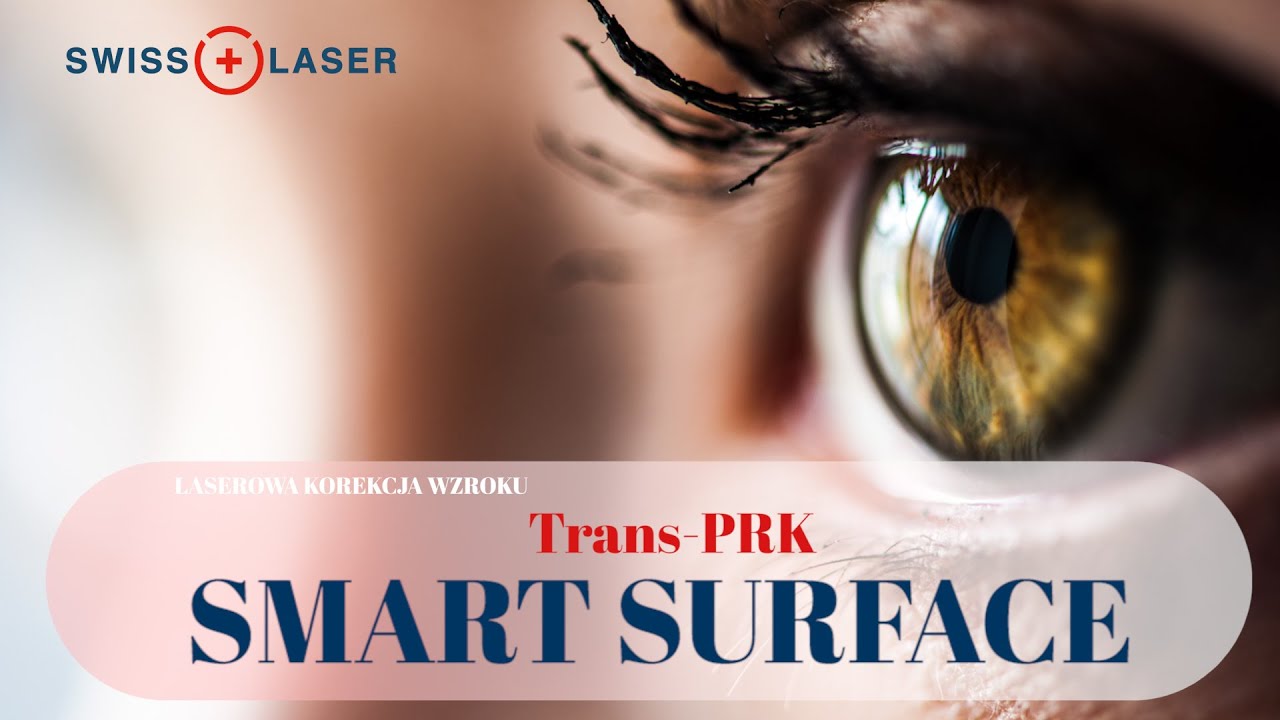 Metoda Trans-PRK Smart Surface - laserowa korekcja wzroku | SwissLaser Warszawa