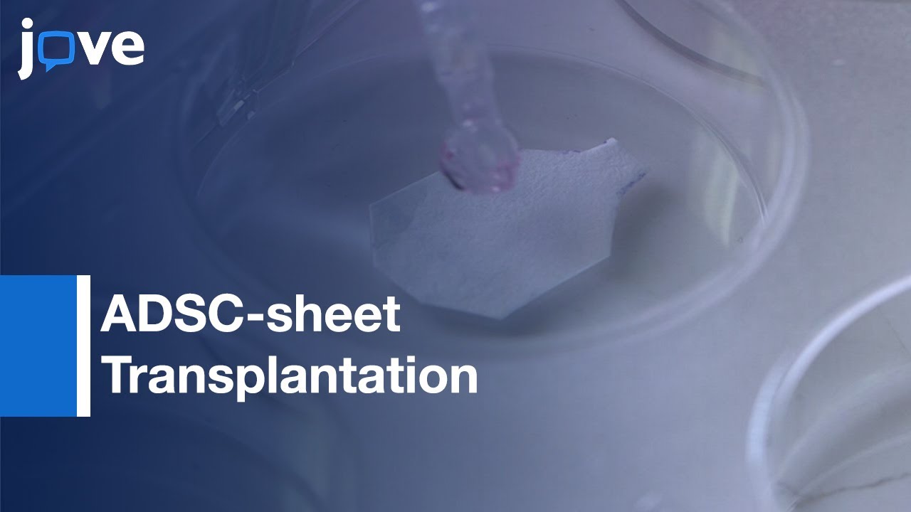 ADSC-sheet Transplantation for Esophageal ESD Stricture prevention | Protocol Preview