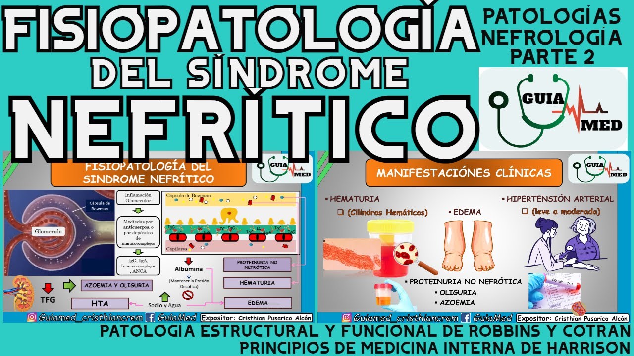 SÍNDROME NEFRÍTICO FISIOPATOLOGÍA | GuiaMed