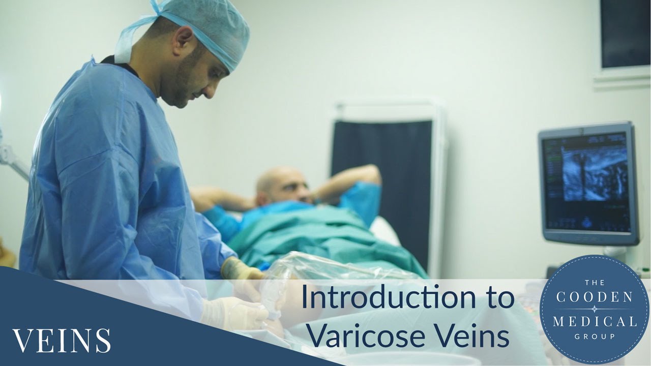 An Introduction to Varicose Veins