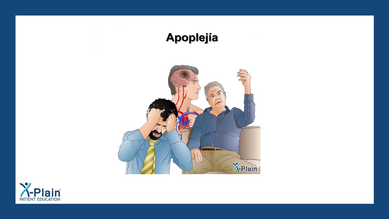 Apoplej&iacute;a
