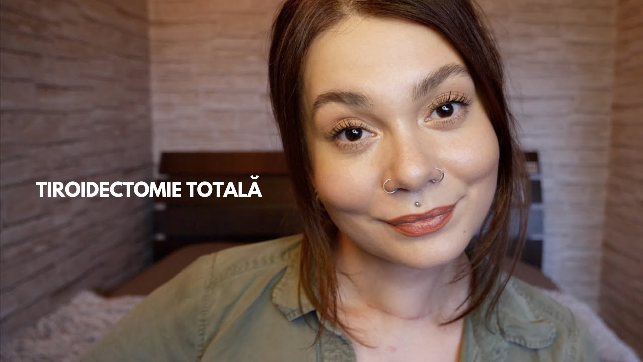 TIROIDECTOMIE TOTALĂ | M-am operat! Experiența mea ❤️&zwj;🩹