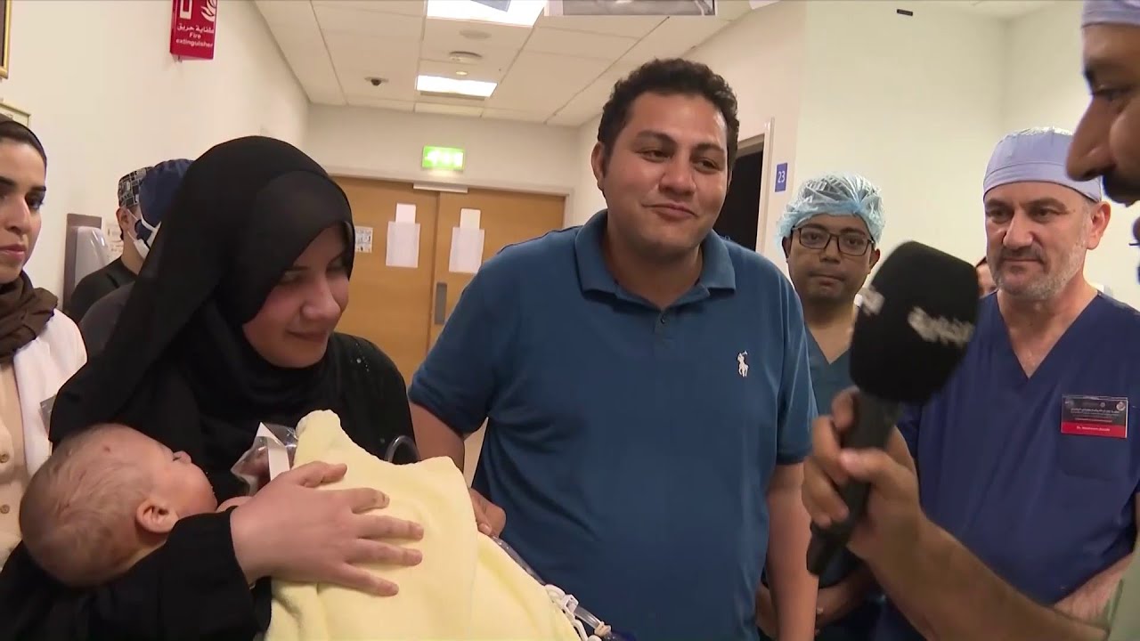 اللحظات الأولى للقاء بين التوأم الطفيلي المصري ووالديه