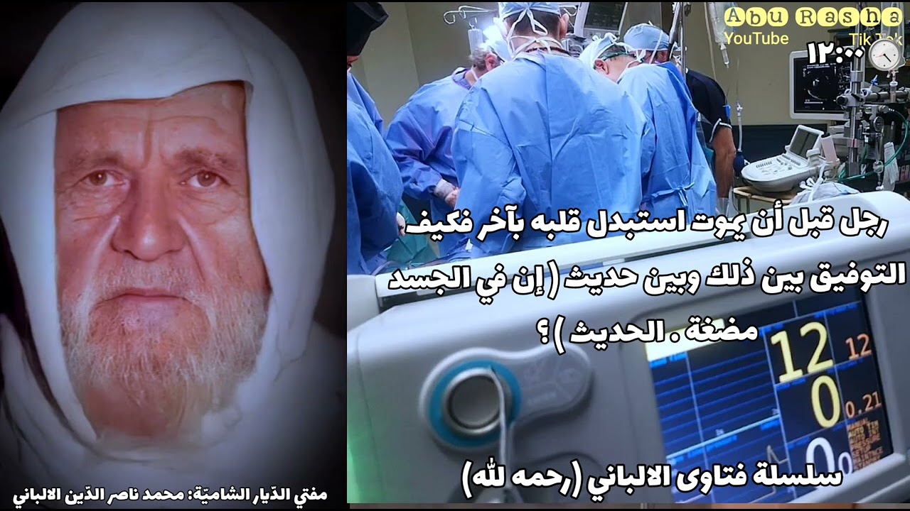 نقاش حول استبدال قلب🫀بقلب آخر《للشيخ الالباني》