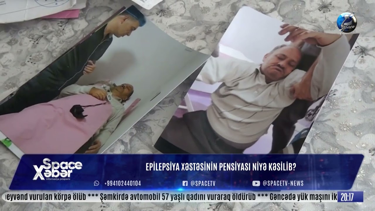 Epilepsiya Xəstəsinin Pensiyası Niyə Kəsilib