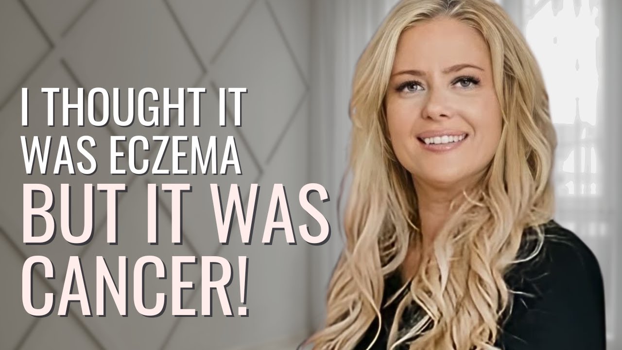 ITCHY Skin to Lymphoma! - Miranda | Hodgkin’s Lymphoma | The Patient Story