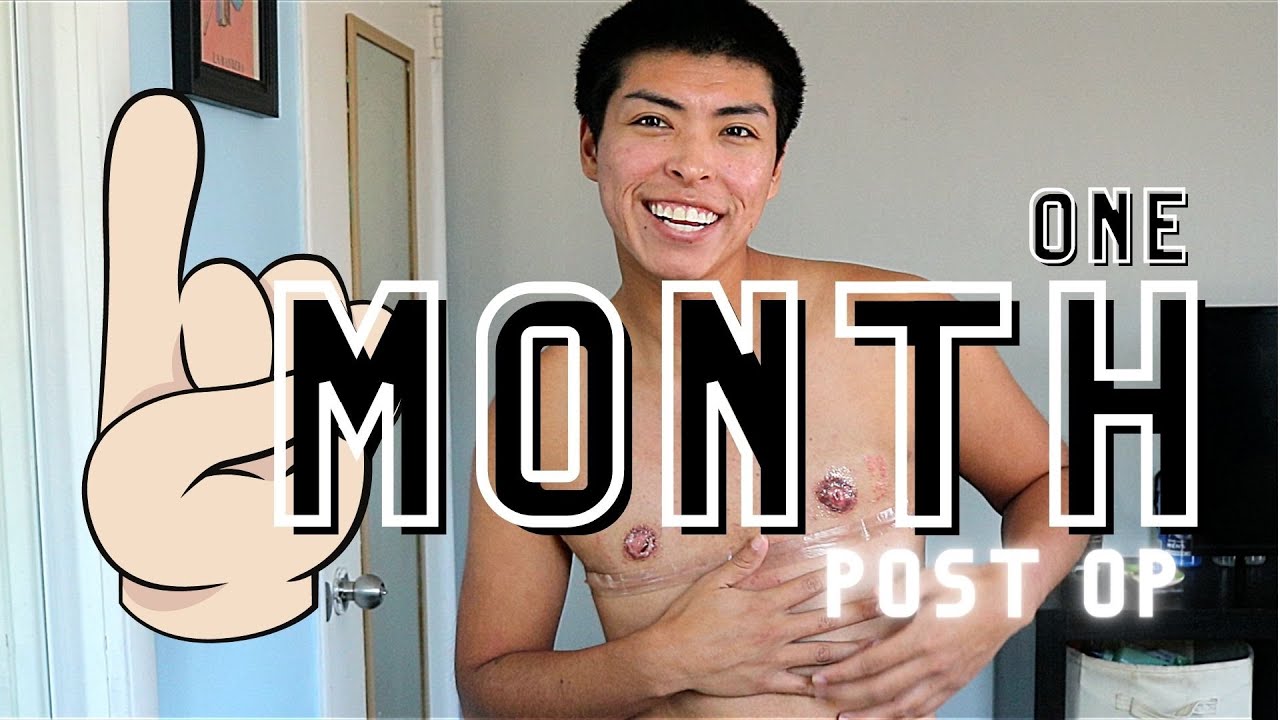 TOP SURGERY | ONE MONTH POST-OP!