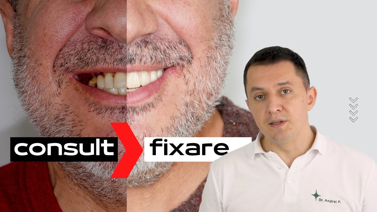 Proteza dentara fixa | Etapele de tratament | Implanturi dentare
