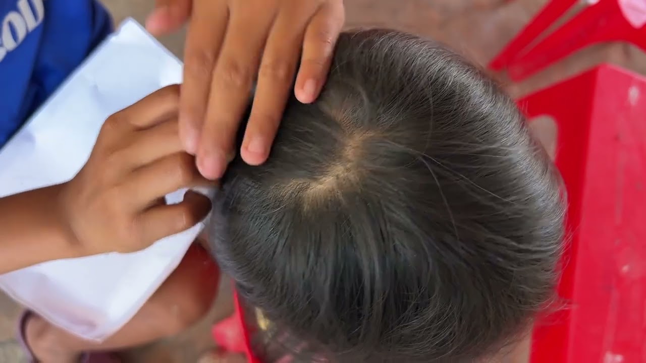 Lice removal for kids 