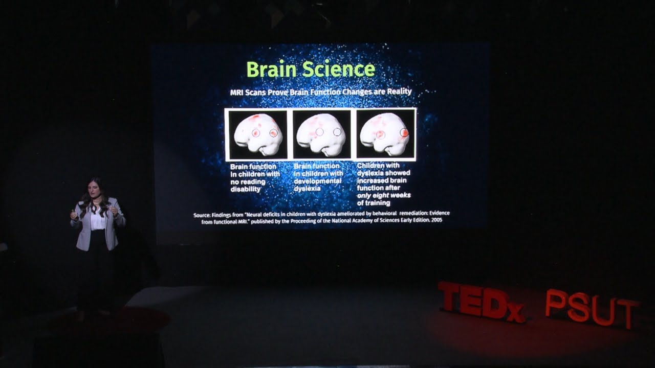 Your Brain: Use it or Lose it. | Dina Halaseh | TEDxPSUT