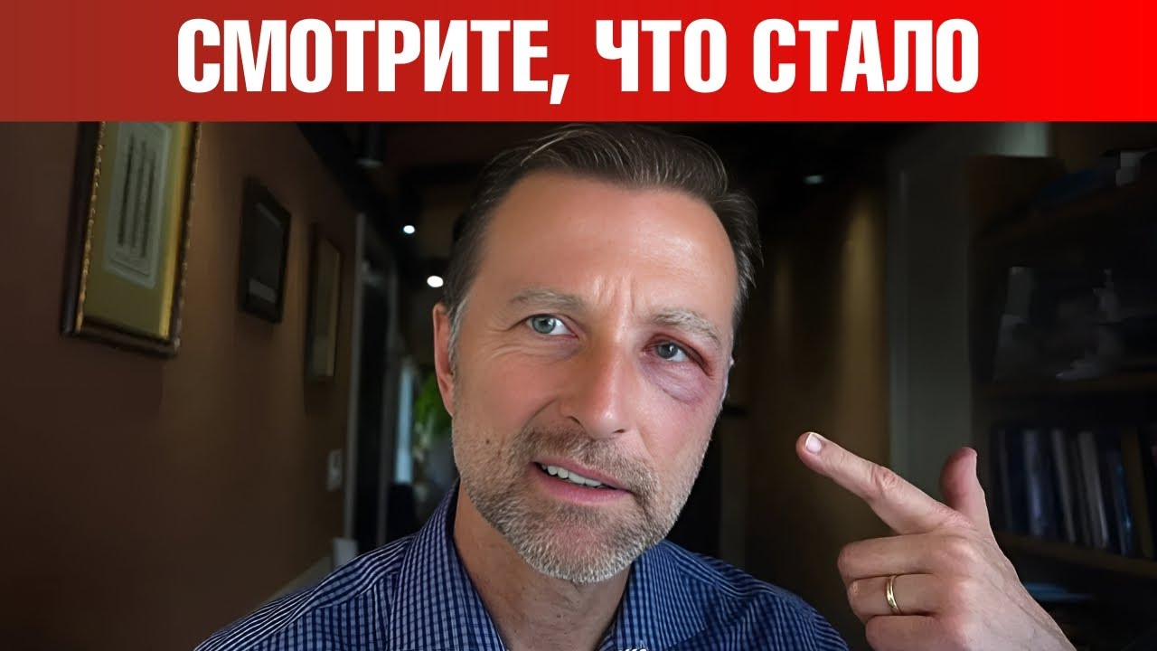 Вот до чего дошло...😲 Стресс, кортизол, преднизон.