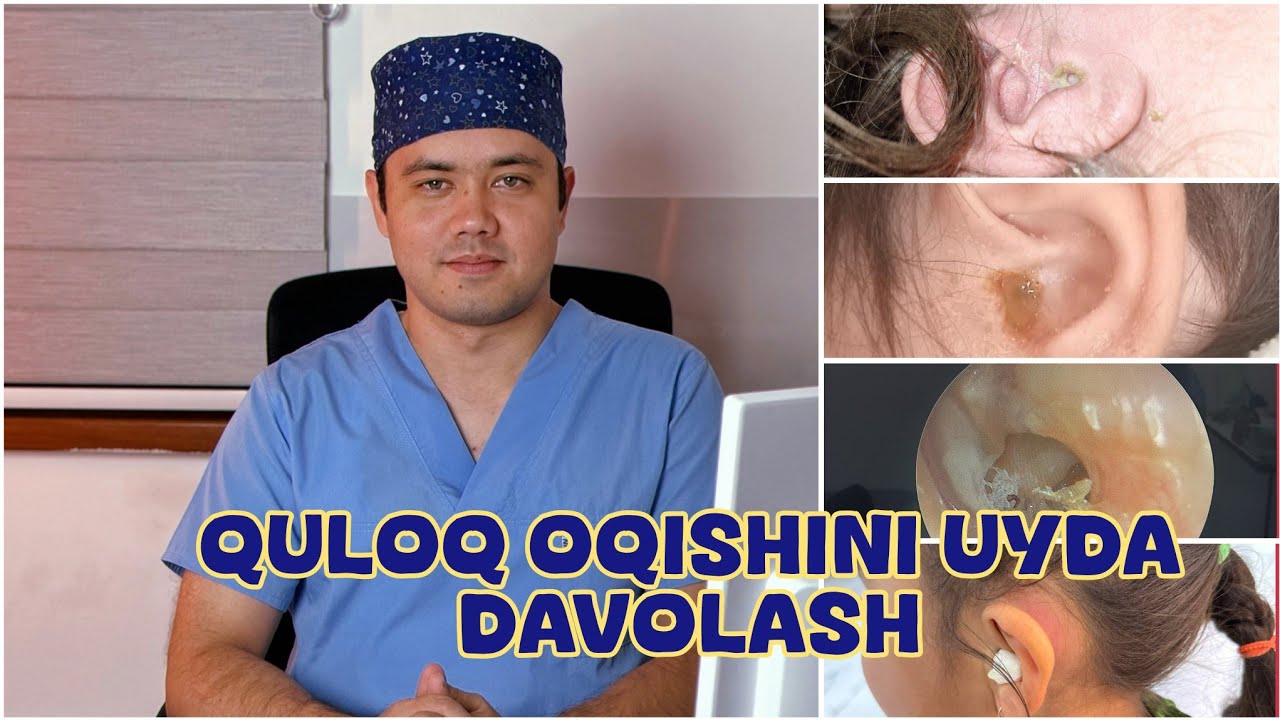 Quloq oqishini bepul va uy sharoitida tez va samarali davolash (murojaat uchun : 970231545 )