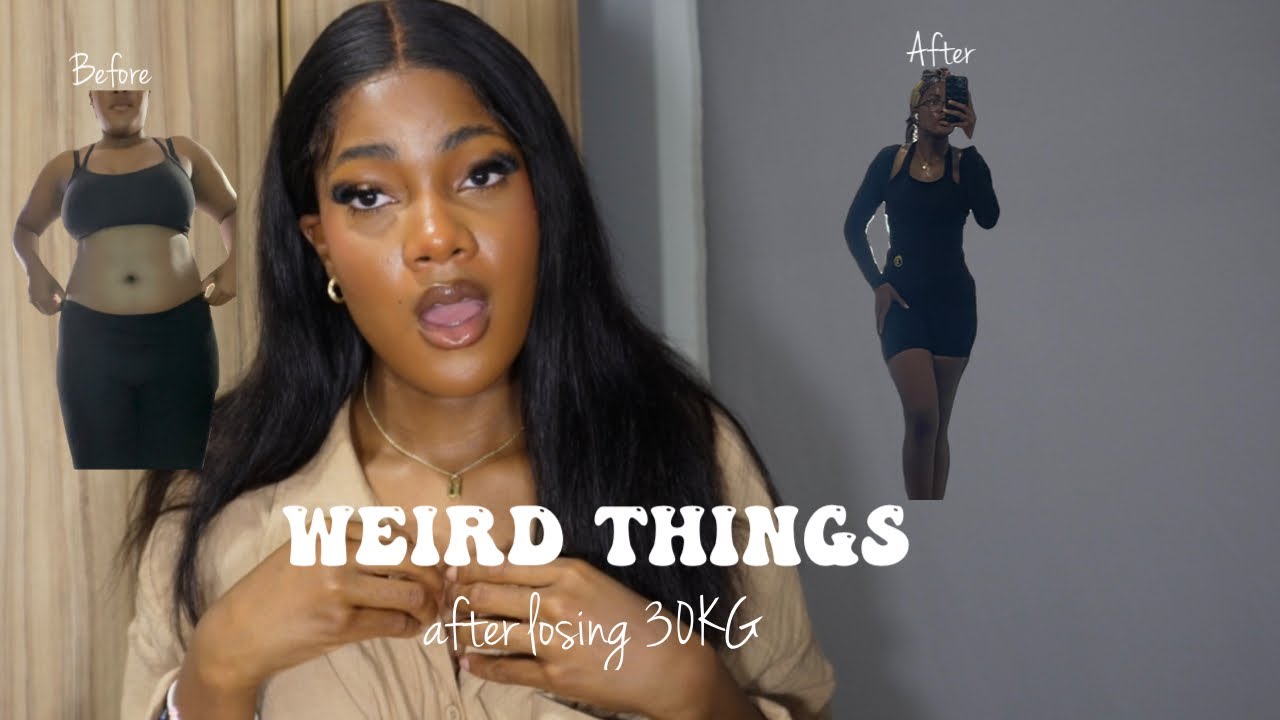 20 things NOBODY Tells You About Life After Weight Loss| Nachy Chike (the way people treat you+more)