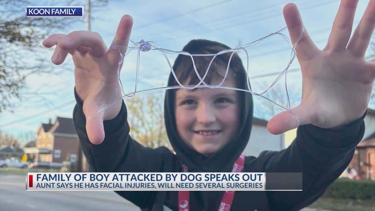 Family of boy attacked by dog speaks out