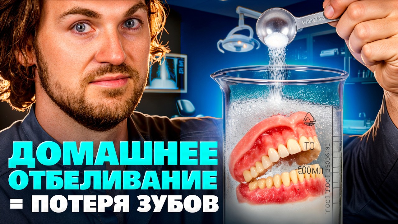 Домашнее отбеливание: 7 ошибок, после которых болят зубы