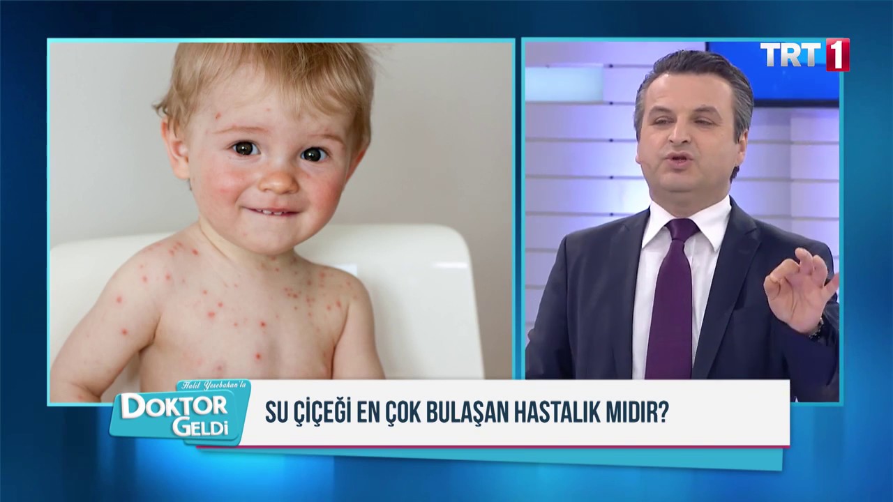 Doktor Geldi - Çocuklarda Mevsim Geçiş Hastalıkları, Su Çiçeği - 11 Nisan 2018
