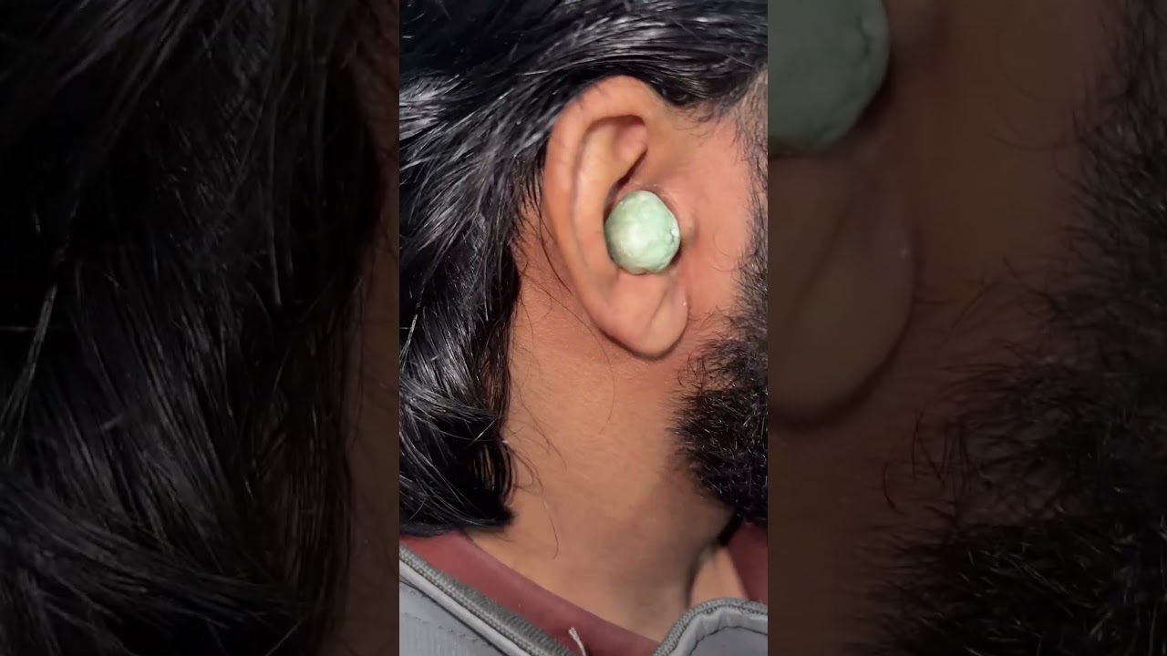 #youtube