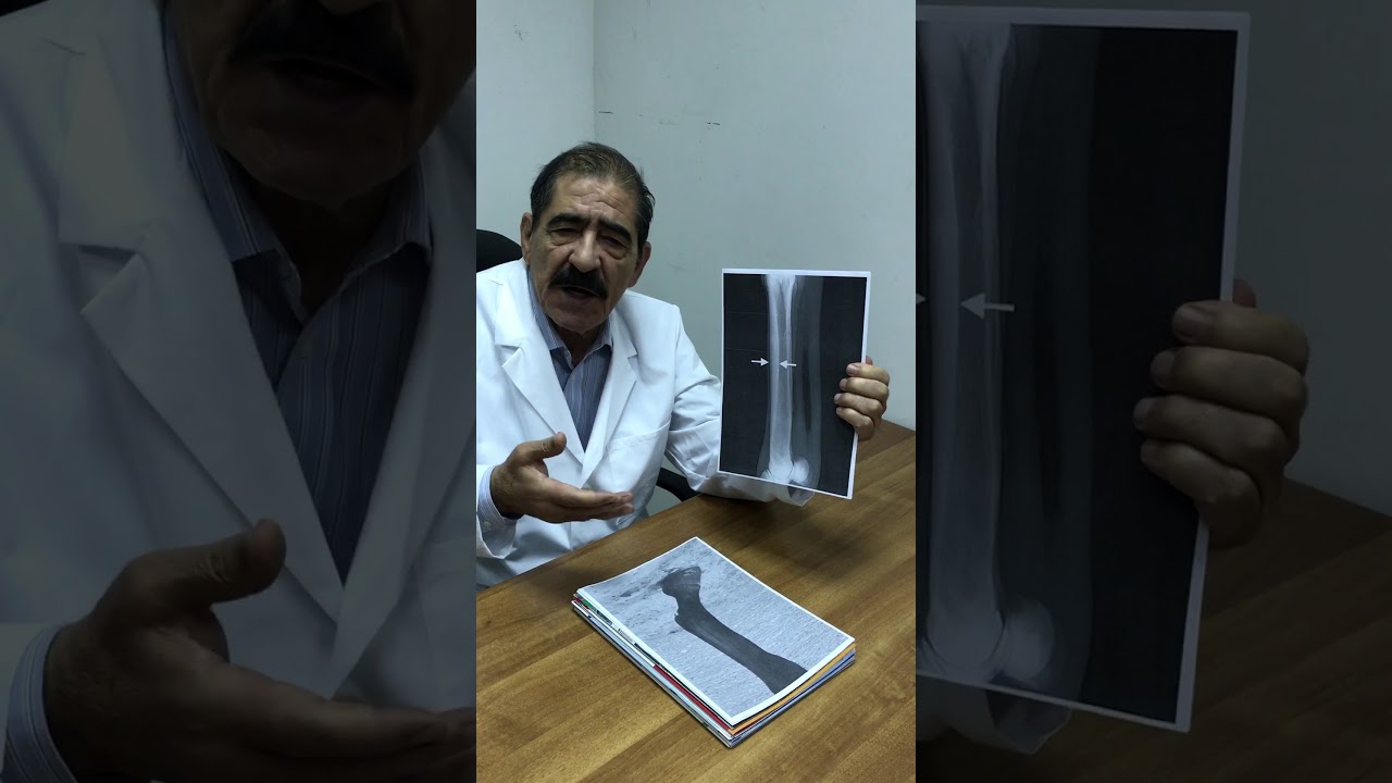 التهاب الاوتار في الخيل tendinitis in equine