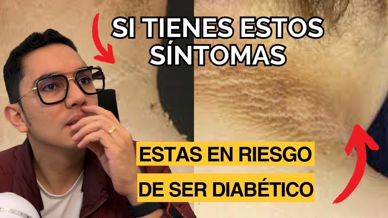 Si tienes estos síntomas estás en riesgo de ser diabético(a) | Dr. William Guerrero