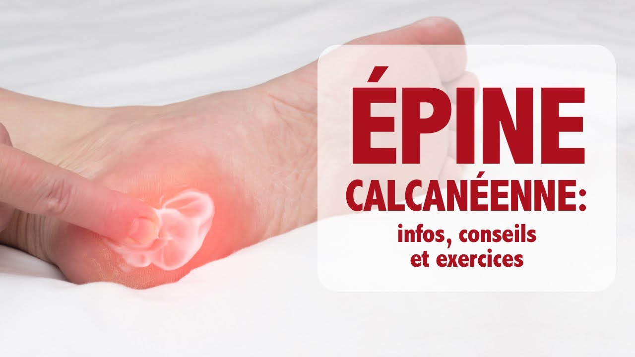 Épine calcanéenne (de Lenoir): informations, conseils et exercices commentés!