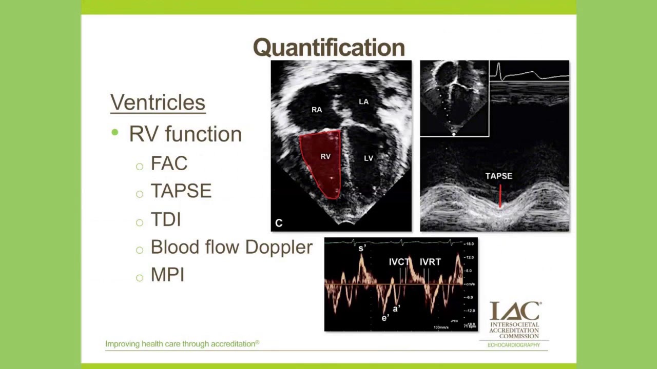 Pediatric Echo Quantification: To Z or Not To Z