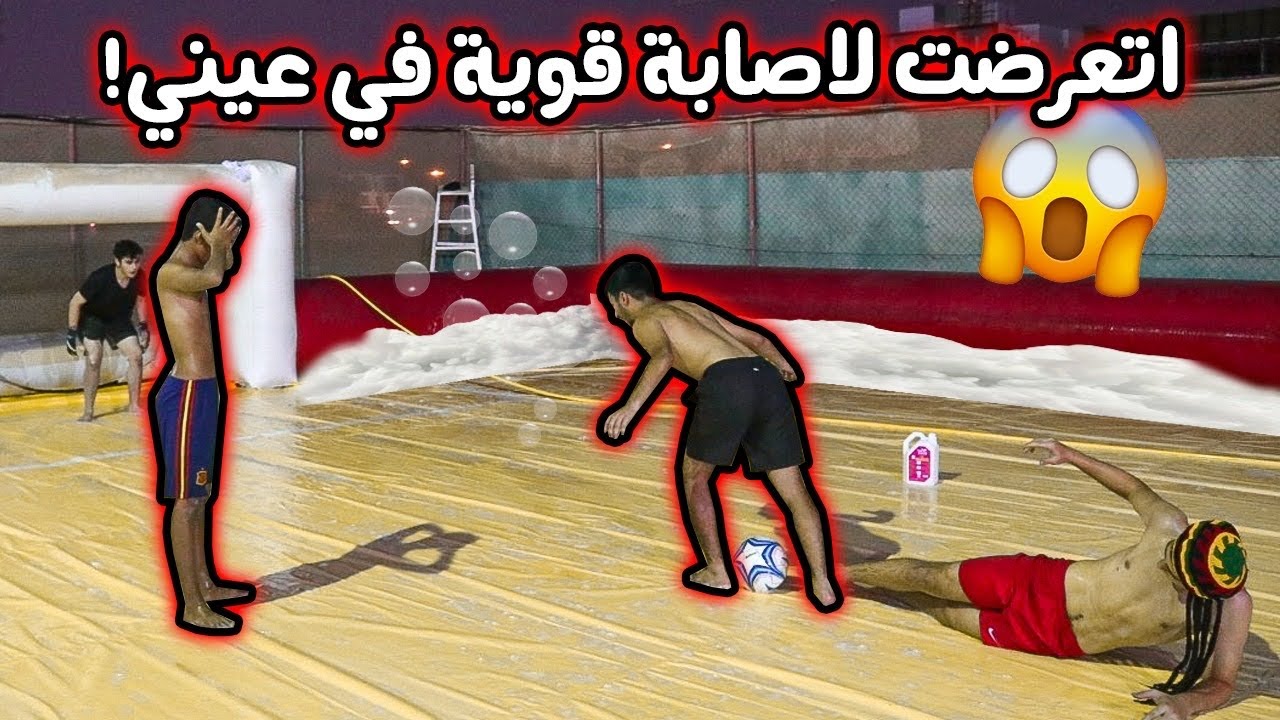 لعبت مباراة قوية و خطيرة على الأرضية الصابونية !! ( تعرضنا لإصابات قوية و خطيرة !! )