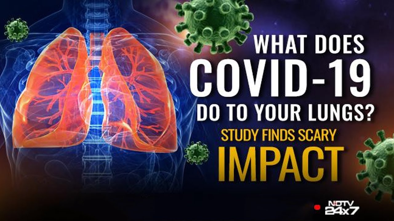 Covid-19 | What Does Covid-19 Do To Your Lungs?
